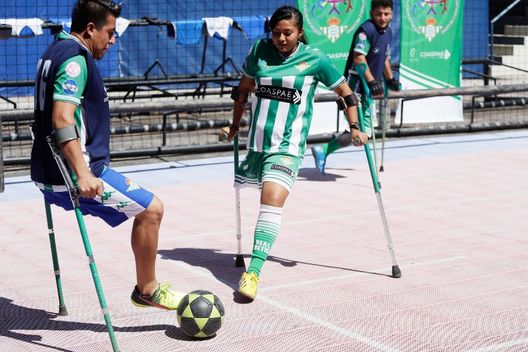 Morso del serpente e gamba amputata: Magdalena, 17 anni, in Europa grazie al Betis- immagine 2