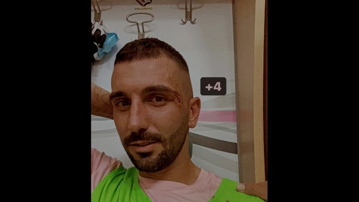 Palermo, Dall&#8217;Oglio &#8220;+4&#8221;: incidente in allenamento e post Instagram dell&#8217;ex Catania 