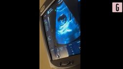 VIDEO / Zaccagni-Nasti presto genitori: le dolci immagini della prima ecografia
