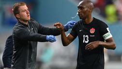Canada, Atiba Hutchinson e quel…Tampax nel naso