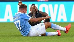 Immobile espulso per manata a Vidal: rischia lunga squalifica