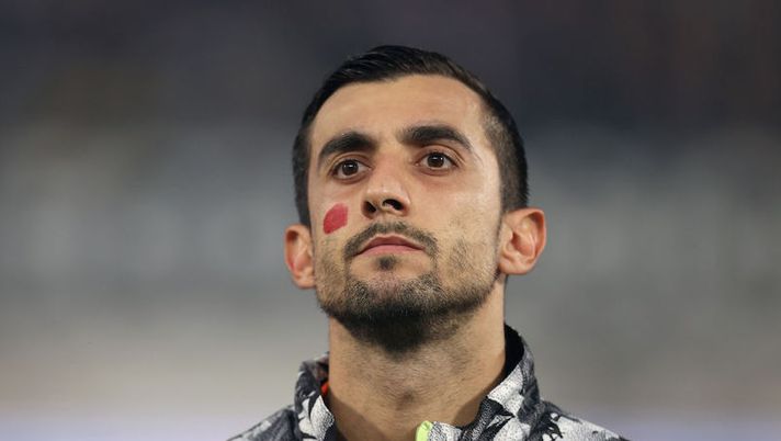LA SPEZIA, ITALY - FEBRUARY 19: Mattia Perin of Juventus FC shows a mark on his face manifesting against the violence on women during the Serie A match between Spezia Calcio and Juventus FC at Stadio Alberto Picco on February 19, 2023 in La Spezia, Italy. (Photo by Francesco Scaccianoce/Getty Images) DAI CAMPI – Perin, Pereyra, Ederson, Casale, Bennacer, Dessers, Wijnaldum: le novità - immagine 1