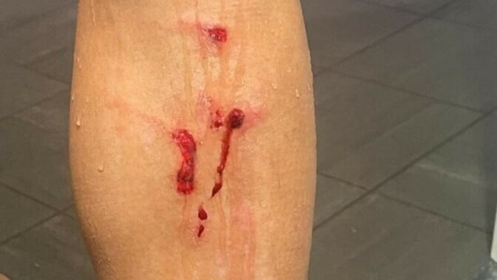 Nizza ko nel derby, l’espulso Dante si scusa con i tifosi: Minamino fa vedere il sangue… - immagine 1