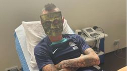 Brozovic, ma che hai in faccia? Marcelo mascherato riparte: “Bare dove sei?”