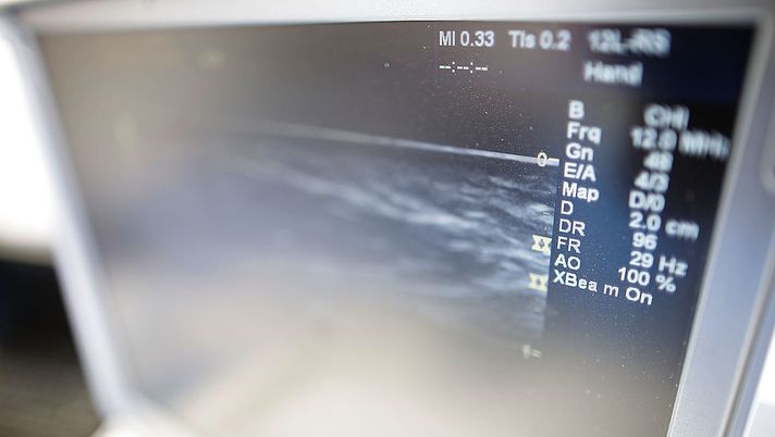 LONDON, ENGLAND - AUGUST 06: Ultrasound scanning machines at the GE Healthcare Expo stall at the Dexto Energy Triathlon ITU World Champonship in Hyde Park on August 6, 2011 in London, England. The race was held over the full Olympic course for the first time, ahead of next years London 2012 Olympics. (Photo by Getty Images for GE Healthcare) LONDON, ENGLAND - AUGUST 06: Ultrasound scanning machines at the GE Healthcare Expo stall at the Dexto Energy Triathlon ITU World Champonship in Hyde Park on August 6, 2011 in London, England. The race was held over the full Olympic course for the first time, ahead of next years London 2012 Olympics. (Photo by Getty Images for GE Healthcare)