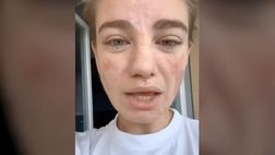 VIDEO / Bebe Vio: “Mi hanno rubato la borsa, c’era il pc con la mia tesi”