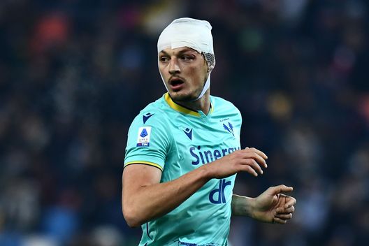 Il Verona perde un attaccante: out per la sfida contro la Fiorentina- immagine 2