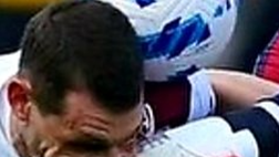 La moviola di Bologna-Torino 0-0: Massimi in balìa della partita. Il Var che fa?