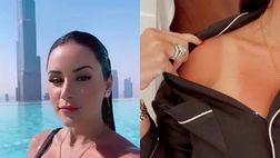 VIDEO / Troppo sole a Dubai per la fidanzata di Douglas Costa: risultato “scottante”
