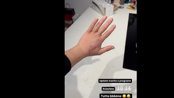 VIDEO / Goggia, l’aggiornamento sull’infortunio: “Ho la mano di ferro”