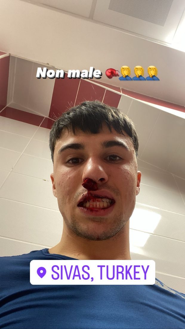 FOTO Grave episodio in Sivasspor-Fiorentina: il viola Bianco colpito da un tifoso- immagine 2