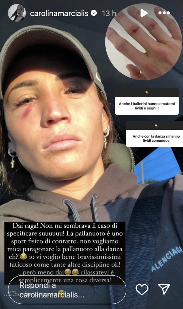 “Lividi? Faccio pallanuoto, non danza”. Carolina Marcialis si scontra con gli haters- immagine 2