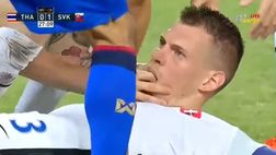 VIDEO / Slovacchia, terrore per Skrtel: rischia di soffocare, lo salva Duda