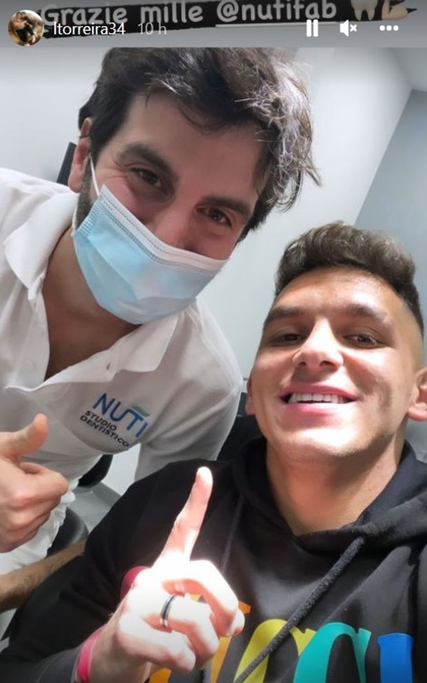 FOTO – Torreira non è più toothless: dente già sistemato- immagine 2