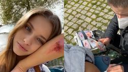 VIDEO / Realtà o finzione? La fidanzata di Joao Felix copre le ferite con il trucco
