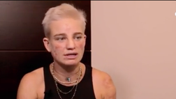 VIDEO / Bebe Vio: “In Italia grandi progressi nella cultura della disabilità. Quando…”