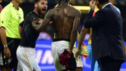 BALOTELLI E LE SCUSE… “PARTICOLARI”