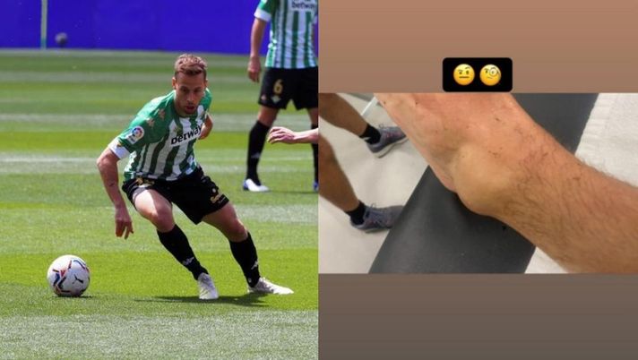 Betis, Sergio Canales: &#8220;Guardate Zaniolo come mi ha ridotto la caviglia&#8230;&#8221; 