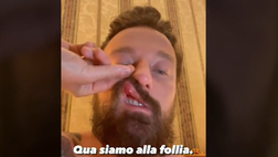VIDEO / Facchinetti aggredito da McGregor: “Violento e pericoloso. Ecco cosa è successo”