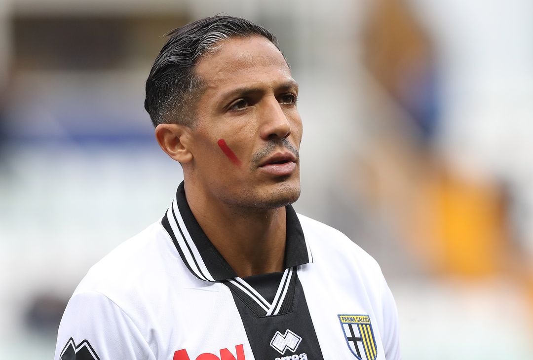  PARMA, ITALY - NOVEMBER 25:  Bruno Alves of Parma Calcio show the red mark on the face to support the campaign Un Rosso Alla Violenza before the Serie A match between Parma Calcio and US Sassuolo at Stadio Ennio Tardini on November 25, 2018 in Parma, Italy.  (Photo by Marco Luzzani/Getty Images) 