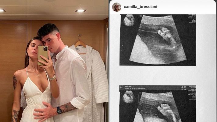 Instagram La compagna di Bastoni condivide l’ecografia: la bimba ha già una somiglianza con il papà - immagine 1