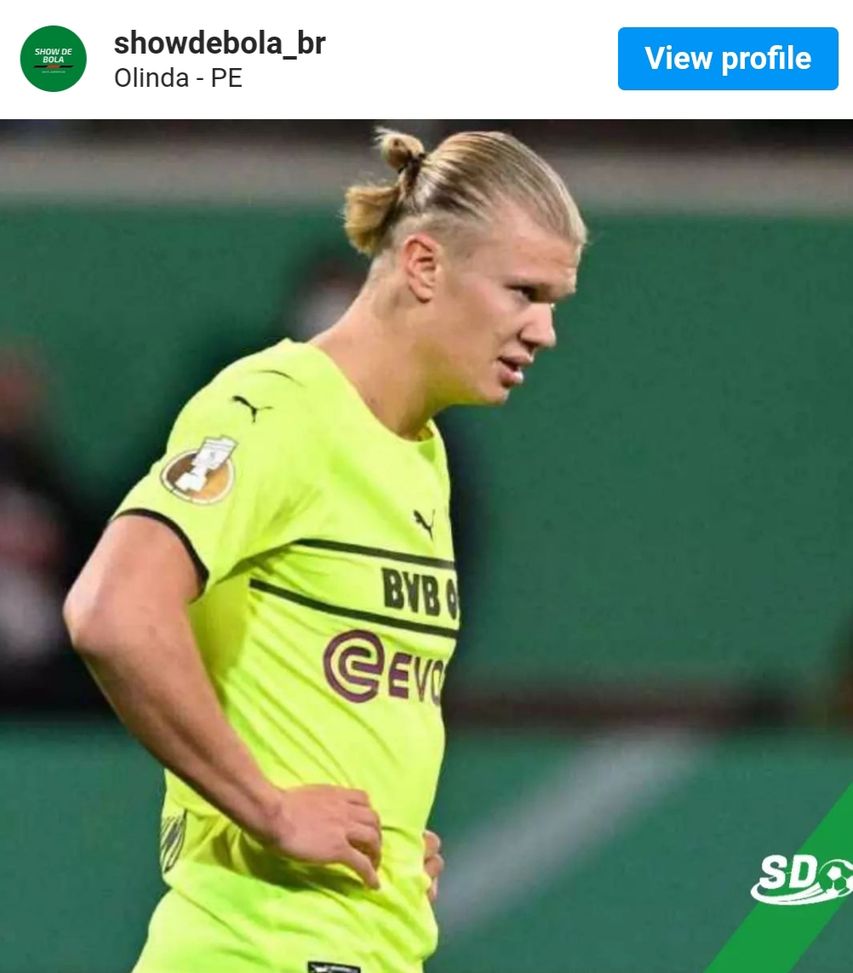 Hijama Terapia: la soluzione della misteriosa macchia sul collo di Haaland…- immagine 2