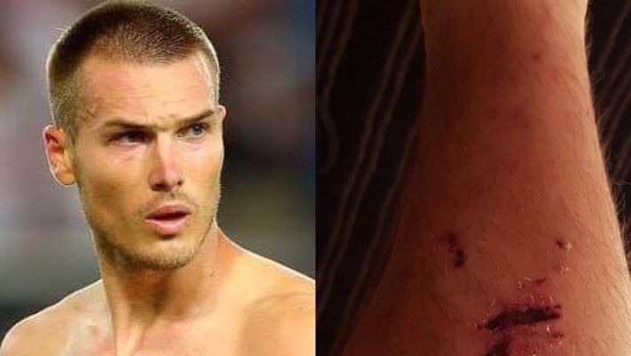 FOTO Toni Sunjic mostra la gamba ferita: “Nulla di preoccupante”. Palermo e futuro… FOTO Toni Sunjic mostra la gamba ferita: “Nulla di preoccupante”. Palermo e futuro…