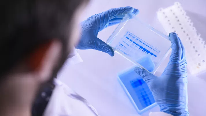 Cittaceleste TV: coronavirus, parla il prof. Carlo Tomino