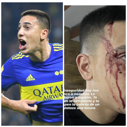 Boca Juniors, disavventura in Argentina: il difensore Sandez aggredito da 4 malviventi- immagine 2