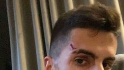 Inghilterra, paura per Cancelo: aggredito e rapinato davanti alla sua famiglia