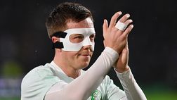 Celtic, highlander McGregor: in campo nel derby con due ossa del volto rotte