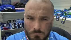 Il gesto del tifoso del Napoli contro il razzismo e a sostegno di Juan Jesus