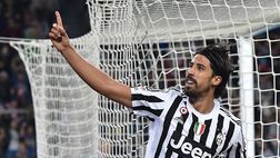 LE PROBABILI FORMAZIONI – Uomini contati per Allegri
