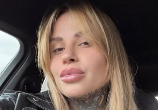 Lady Hernandez si difende dopo l’operazione al seno: “Non fate domande se poi non…” - immagine 1