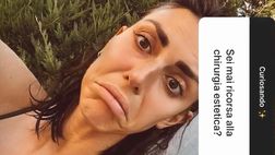 VIDEO / La moglie di Bonucci si confessa sui social: “Chirurgia estetica? Mi sono rifatta…”