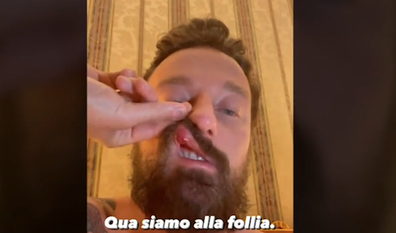 Scardina vs McGregor: “Aggressione a Facchinetti senza senso. Per noi pugili…”- immagine 2