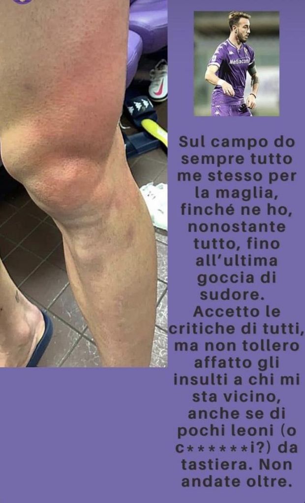 ? FOTO – Castrovilli esplode e fa vedere l’infortunio: “Basta insulti, non andate oltre”- immagine 2