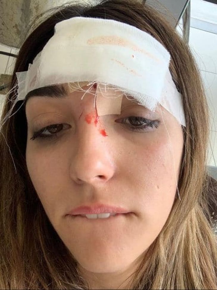 La moglie di Nandez Cagliari, il sangue sul volto della moglie: Nandez “I fatti denunciati sono falsi”- immagine 2