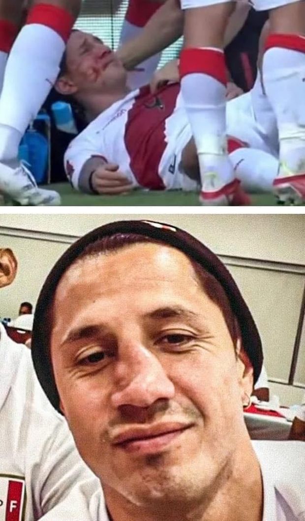 FOTO Lapadula batte la Colombia di Ospina ma ci rimette il naso, che botta per lui!- immagine 3