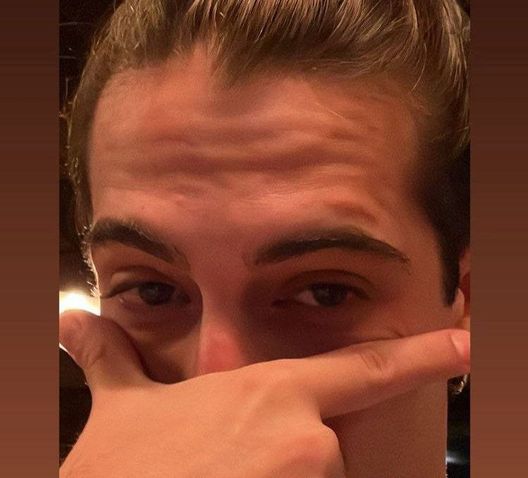 Damiano dei Maneskin esulta con la Dybala mask. E la Joya apprezza- immagine 2
