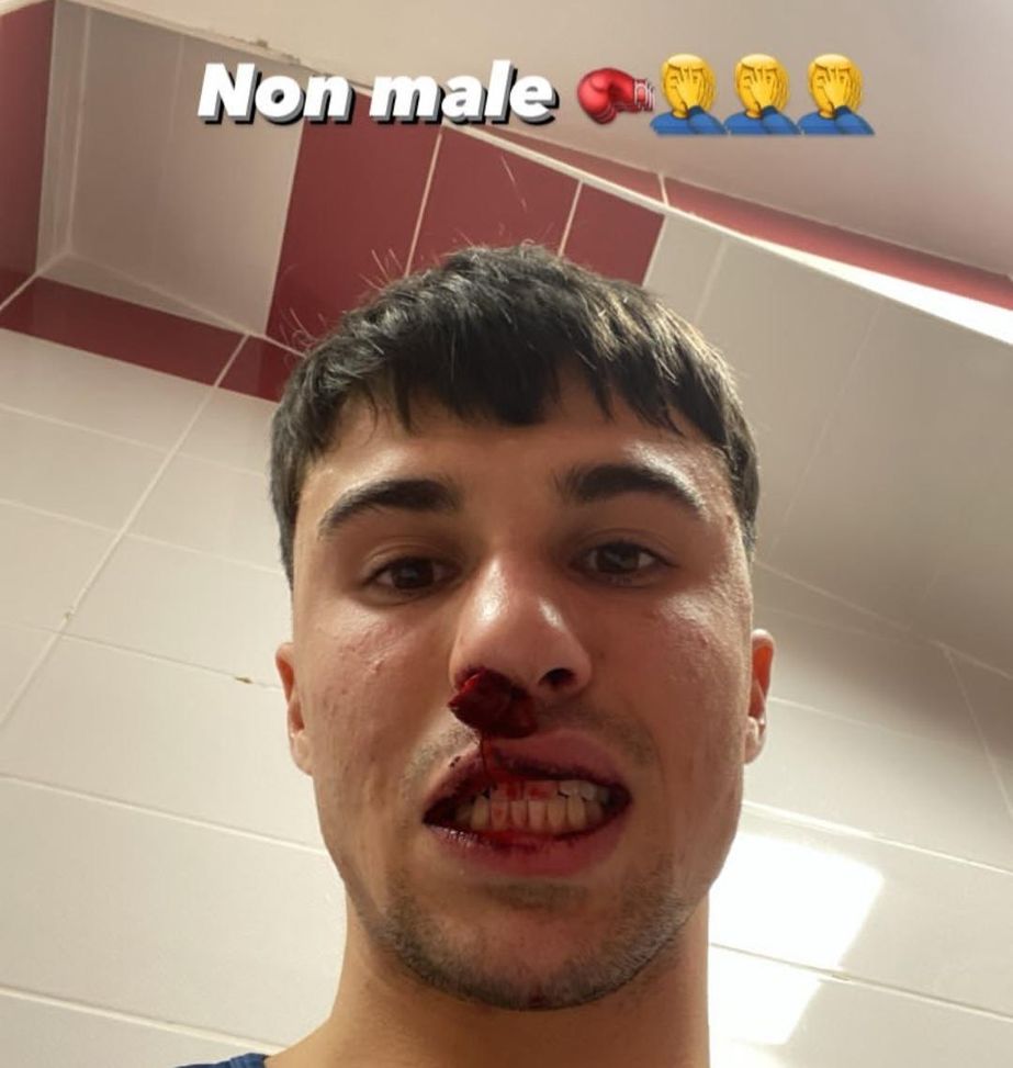 Bianco non si opera. Ed il Sivasspor rischia la maxi squalifica- immagine 2