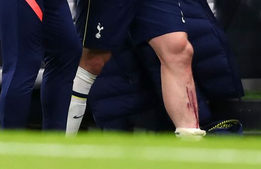 Hojbjerg Tottenham (getty images) Hojbjerg Tottenham (getty images)