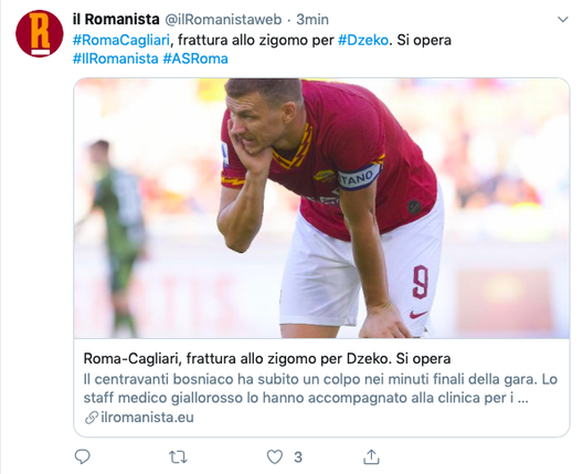 Infortunio per Dzeko: frattura allo zigomo, si opera e quando torna in campo- immagine 2