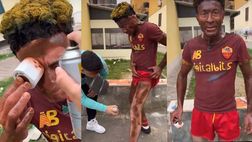 Lo dipingono come Abraham eroe del derby, ma nel video lo chiamano “mongoloide”…