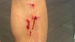 Nizza ko nel derby, l’espulso Dante si scusa con i tifosi: Minamino fa vedere il sangue…