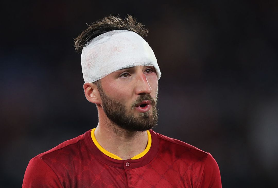 Roma-Udinese 3-0 – FOTO GALLERY - immagine 18