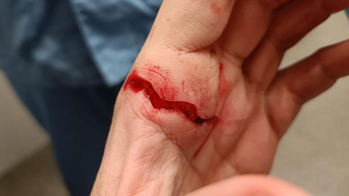 Shock in Spagna, tifosi armati in campo: tecnico accoltellato salva la vita al preparatore - immagine 1