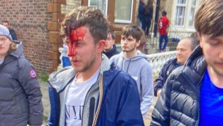 Sangue dal volto e spogliatoi devastati: il sapore acre del derby di Liverpool Sangue dal volto e spogliatoi devastati: il sapore acre del derby di Liverpool - immagine 1