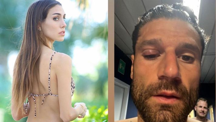 Occhio gonfio per Candreva, la futura moglie ironizza: “Pronto per il matrimonio”  Occhio gonfio per Candreva, la futura moglie ironizza: “Pronto per il matrimonio” - immagine 1