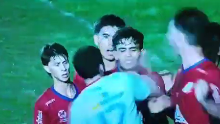 Follia in Uruguay, terribile pugno al volto dell'avversario (Fonte Video Account X Panenka Sport - Osvaldo de Arrascaeta Ramos) Follia in Uruguay, terribile pugno al volto dell'avversario (Fonte Video Account X Panenka Sport - Osvaldo de Arrascaeta Ramos)